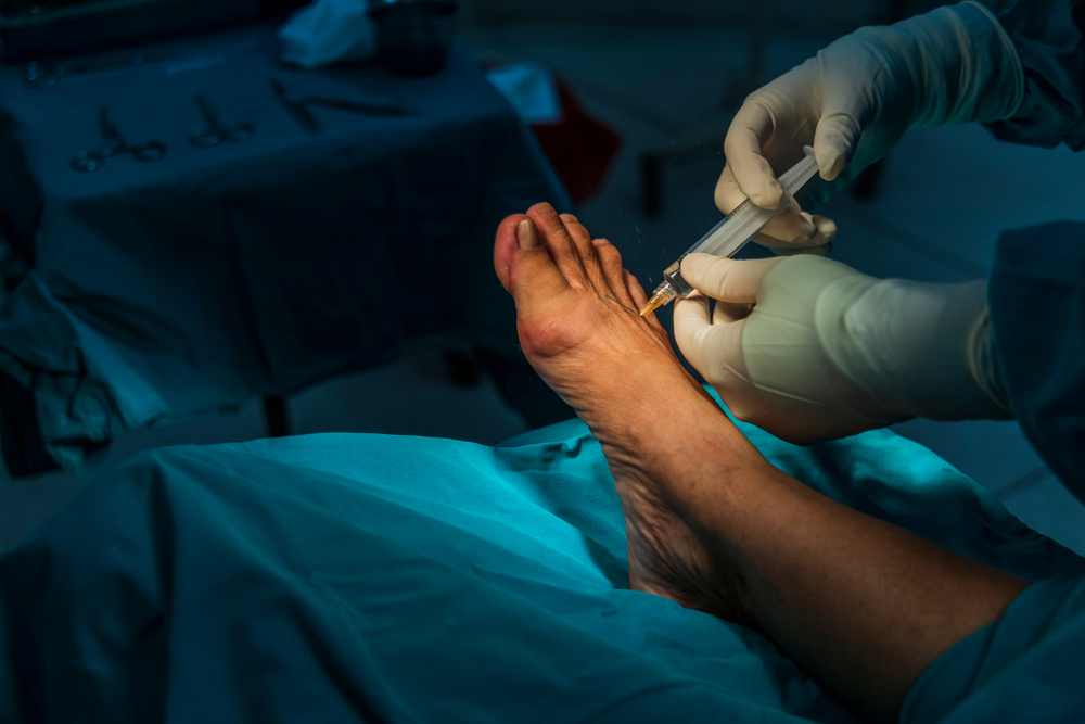 Podiatrist examining foot bunion before bunion surgery consultation