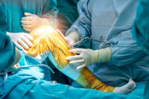 Best doctors for minimally invasive knee replacement consulting pre-operatively