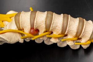 Doctor explaining disc bulge treatment options using spinal anatomy model