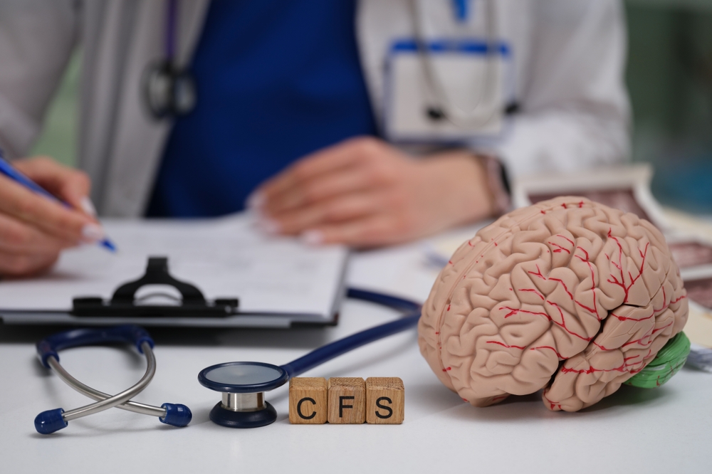 CFS letter blocks with brain model and stethoscope on doctor chronic fatigue syndrome specialist desk