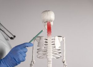 Medical professional pointing to cervical spine on anatomical model showing disc prolapse in the neck location