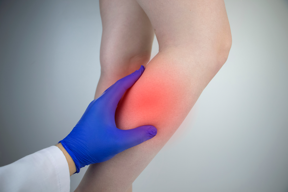 Healthcare provider evaluating calf muscle cramps during leg cramps treatment's calf with highlighted pain area during leg cramps treatment