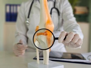 Doctor examining knee model showing meniscus anatomy during consultation