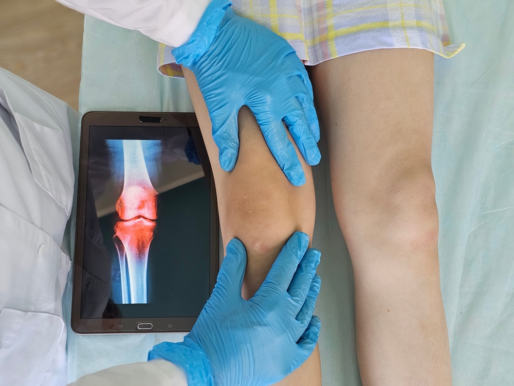 Healthcare provider examining knee symptoms during meniscus tear evaluation's knee during meniscus tears treatment evaluation