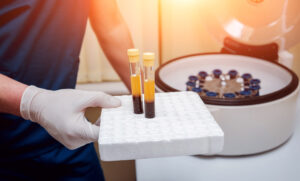 Medical professional preparing PRP injection for patient treatment