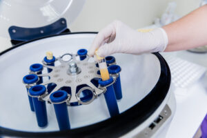 Medical professional preparing PRP treatment in New Jersey clinic