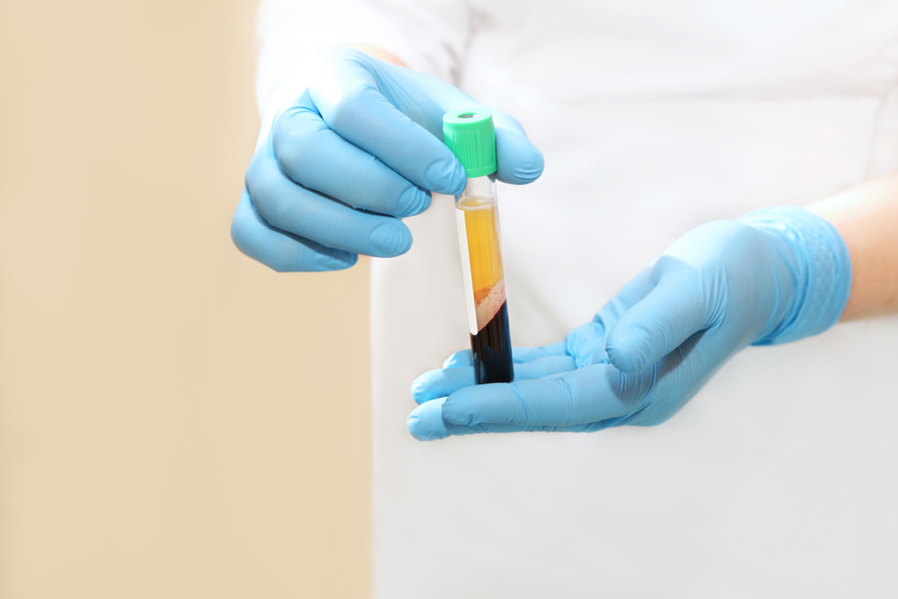 Healthcare provider processing platelet rich plasma for patient treatment