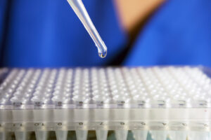 Patient receiving stem cell injection for back pain treatment