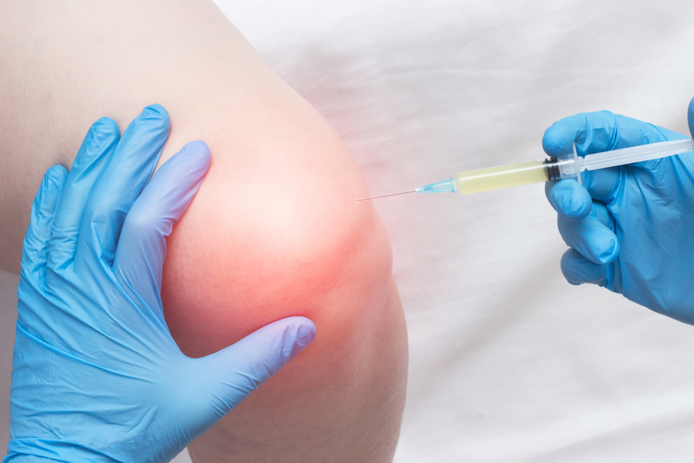 Medical provider performing viscosupplementation knee injection