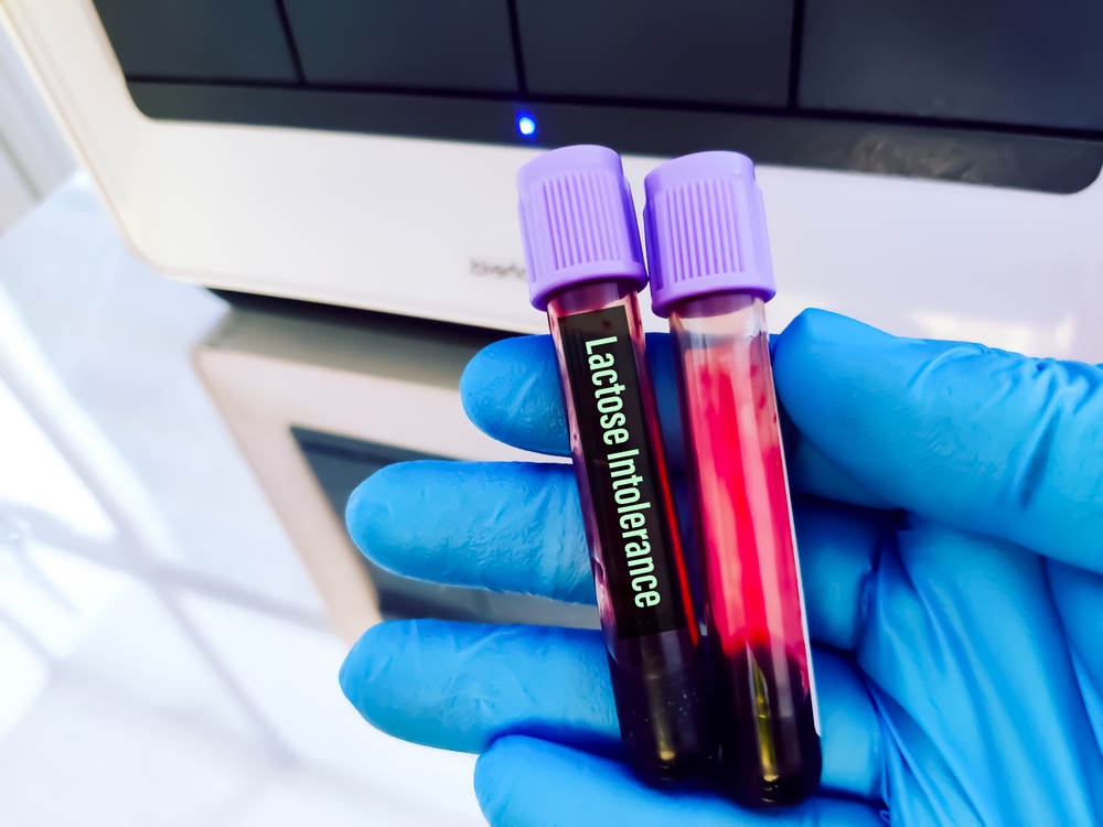 Healthcare professional holding multiple blood sample vials for comprehensive allergy panel testing