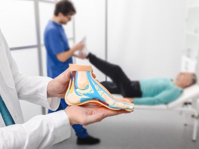 Doctor holding anatomical foot model showing arch structure during foot arch pain consultation