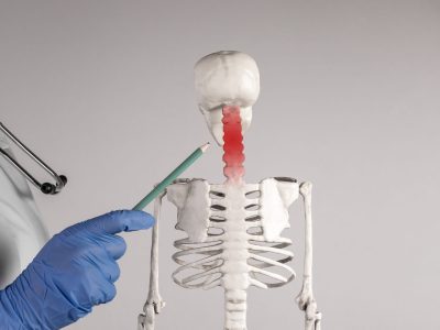 Medical professional pointing to cervical spine on anatomical model showing disc prolapse in the neck location