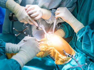 Joint replacement specialist consulting with patient about surgical options
