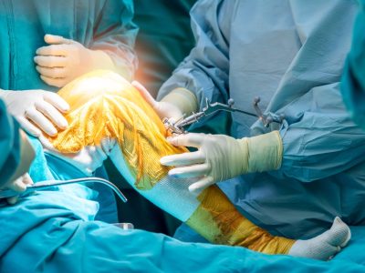 Best doctors for minimally invasive knee replacement consulting pre-operatively