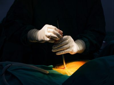 Spine specialist explaining types of minimally invasive spine surgery to patient