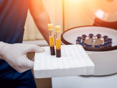 Medical professional preparing PRP injection for patient treatment