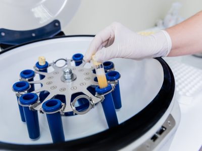 Medical professional preparing PRP treatment in New Jersey clinic