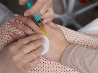 Medical team preparing stem cell therapy treatment for patient