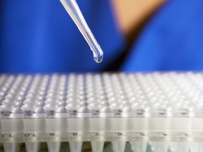 Patient receiving stem cell injection for back pain treatment