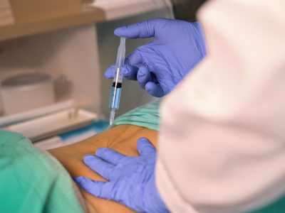 Physician administering epidural steroid injection to patient's lower back