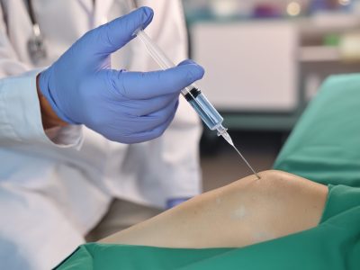 Physician administering Synvisc injection into patient's knee joint