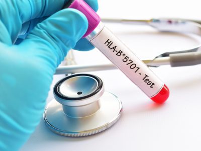Gloved hand holding labeled blood test vial for allergy testing with stethoscope in background