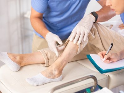 Healthcare provider examining patient during varicose veins treatment consultation