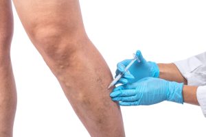 Healthcare provider examining patient during venous insufficiency treatment consultation
